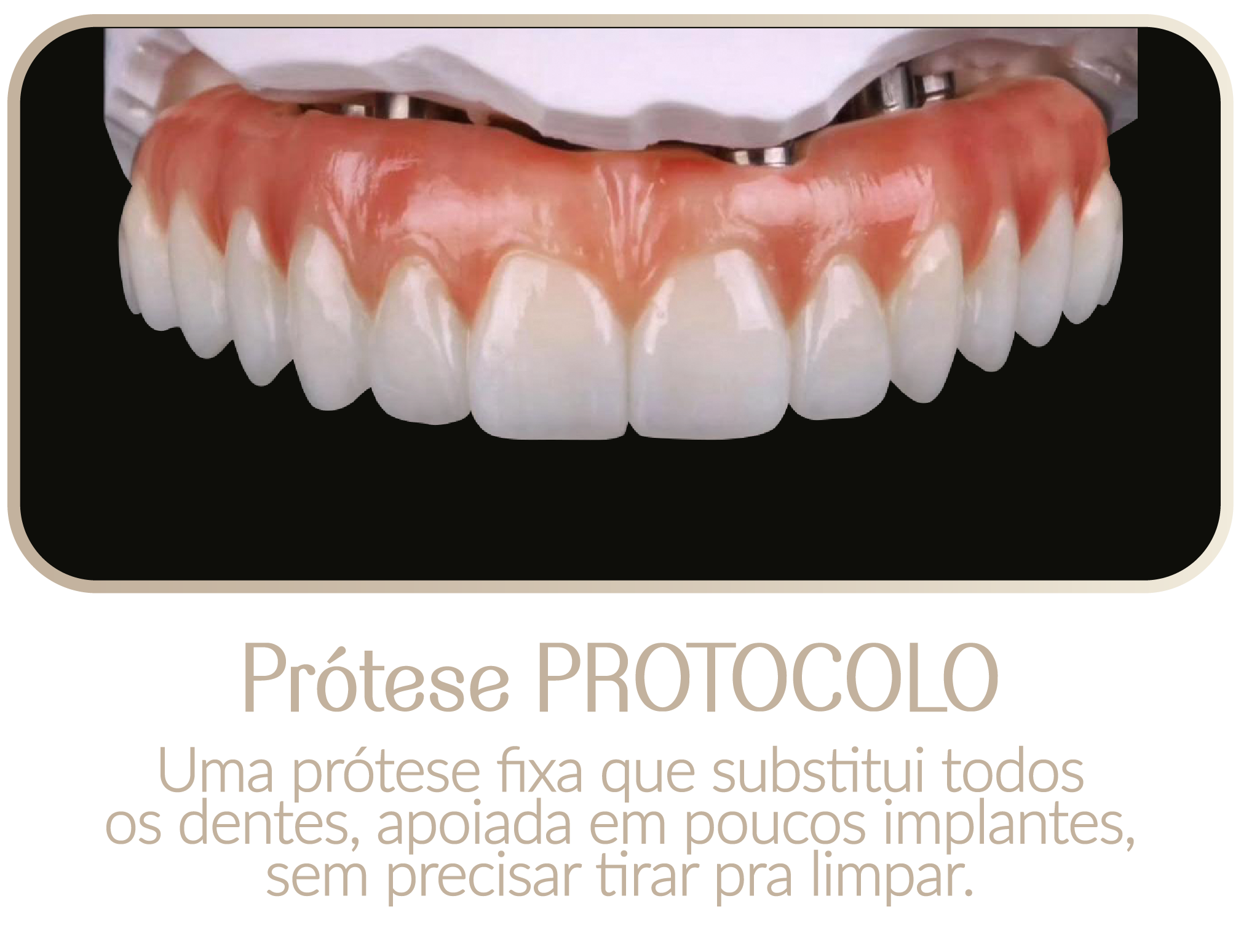LP-19